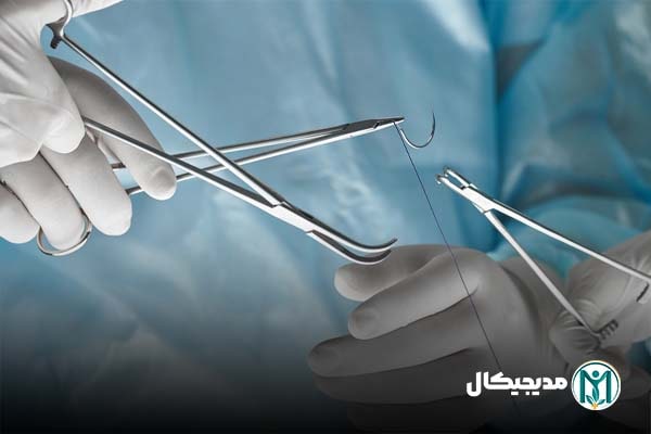 قیمت نخ بخیه کرومیک
