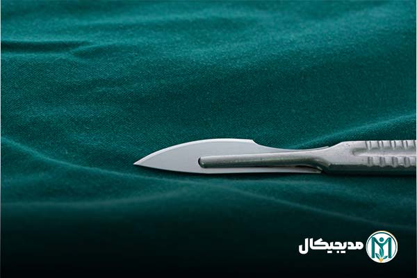 تیغ بیستوری