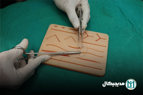 راهنمای انتخاب نخ بخیه