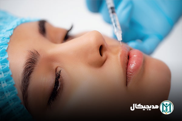 ژل لب برای جوانسازی
