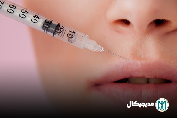 انواع ژل لب با قیمت