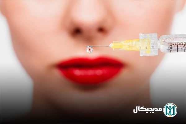 فیلر لب نیمه دائم