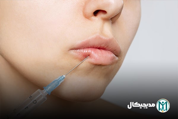 ژل نرم کننده لب