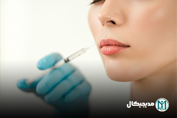 ژل لب هیالورونیک سید