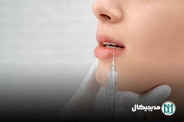 ژل لب از کجا تهیه کنیم