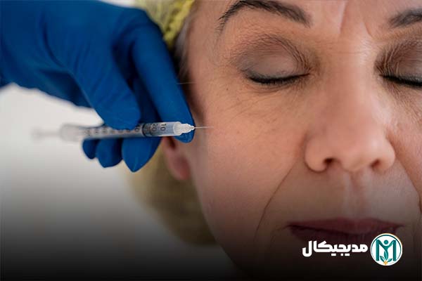 رفع تیرگی زیرچشم