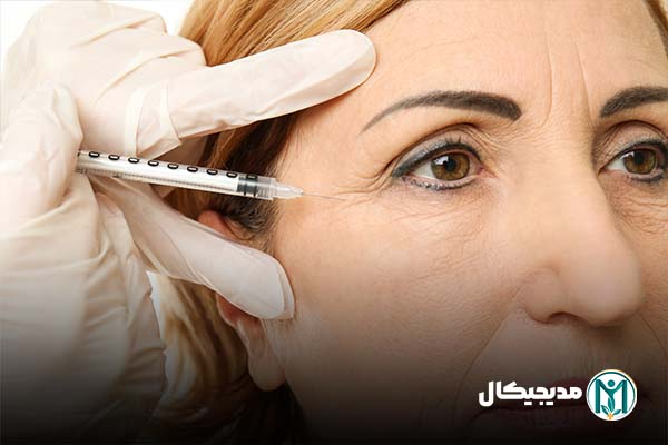 رفع گودی زیر چشم
