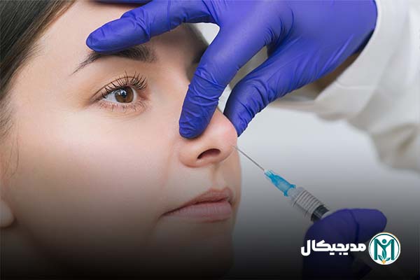 فیلر بینی