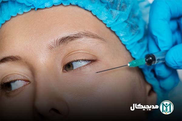 فیلر زیر چشم هیدروکسی لاپاتیت کلسیم