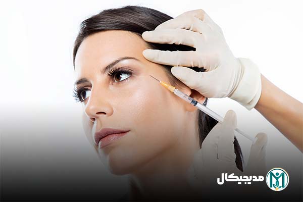 فیلر زیر چشم پلی ال لاکتیک اسید
