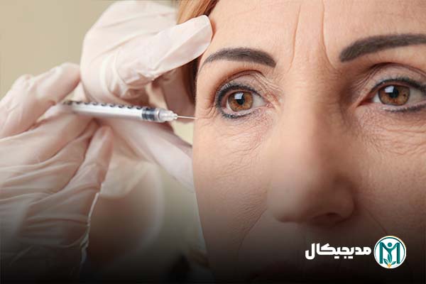 قیمت فیلر زیر چشم