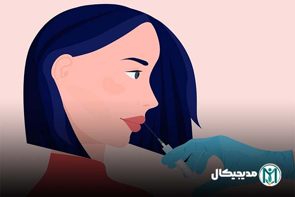 ماندگاری ژل و فیلر