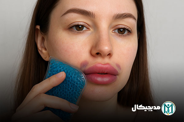 مراقبت های پس از تزریق فیلر های رووفیل
