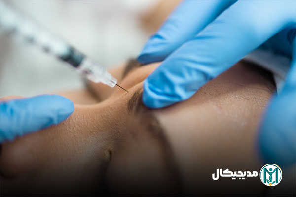 مزایای تزریق فیلر نورامیس