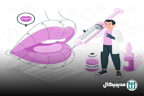 خرید ژل