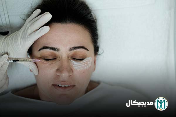 کاربردهای فیلر چشم