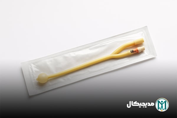 جایگذاری سوند فولی