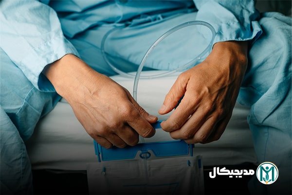 سوند ادراری