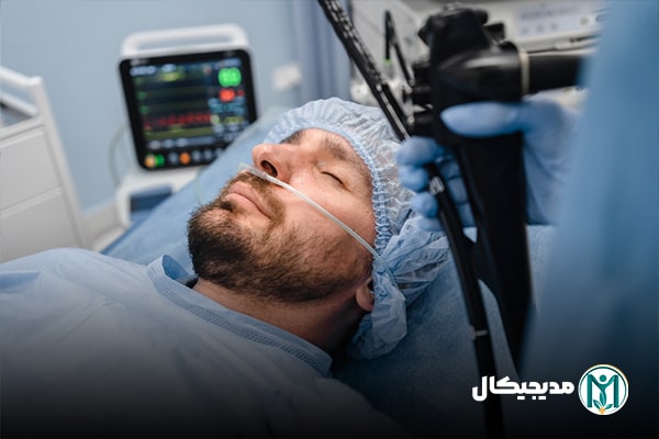 سوند معده