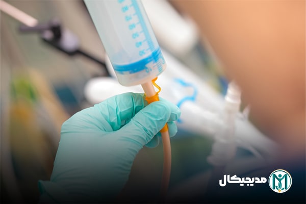 سوند گاستروستومی