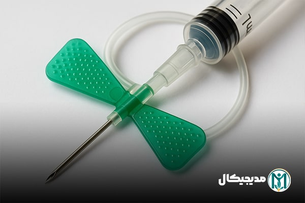 اسکالپ