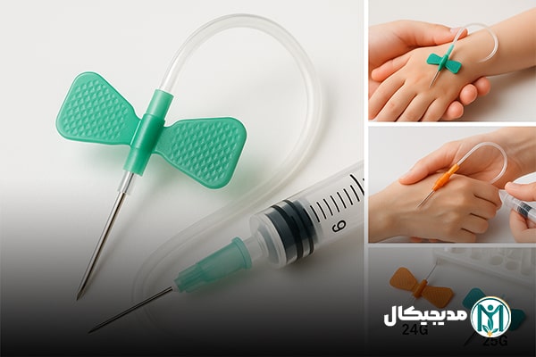 اسکالپ وین