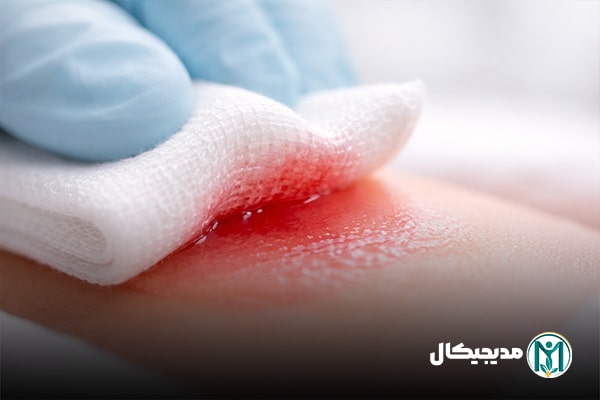 قیمت گاز استریل